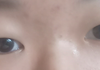 제발ㅠ 눈성형 좀 봐달라고 한사람인데 도와주세요