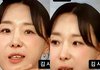 '인중 축소술' 이지혜, 생방송 중 앞니에 김 포착.."이런 젠장"
