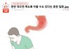 한번 겪으면 죽도록 아플 수도 있다는 흔한 질환.jpg