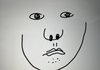 인중 늘리는 수술은 없음?