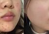 이너뷰티 솔직히 효과없을줄 알았는데;;