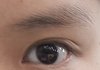 나 쌍수할까