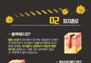 블랙헤드에 직빵이라는 거