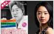 동안 성형, 서우성형 유행하는 성형