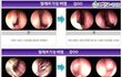 춥고 건조한 겨울~!! 비염걱정없이 보내는 비법