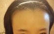 ((사진有))저보다이마 넓으신분? 없음