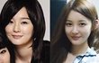 안면윤곽 성형한 것 같은 여자 연예인