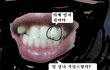 나 앞에 이빨하나 큰일남 인증샷 有 도와줘 나힘들어. 걱정되미치겠어.
