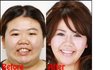 ★★혐오,충격주의★일본인 성형 비포 앤 애프터(사진有)★★