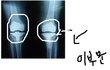 성장판 확인법 사진(有)@@@@@@@@@@@@@@@@@@@@@@@@@@@@@@@@@@@@@@@@