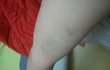 사진첨부)식당종업원한테 맞았어요ㅠ_ㅠ 그런데 그쪽이 오히려 저를 고소했습니다 도와주세요