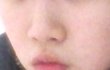 사진有)중학생이구요...제 코좀 봐주세요 ㅜㅜㅜ