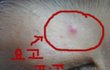 얼굴이랑 팔에 이런거 나는데 왜그러는지 아시는분 ㅠㅠ