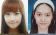 ★★★소녀시대 양악했다고요?★★★
