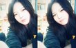 사진多 눈 쌍수하고싶은데요..ㅠㅠ