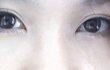 (사진 有)눈 수술 한거 같나요??