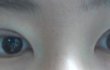 나 오늘 쌍수 완전절개햇는데 속쌍될꺼같아??