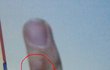 ★★★사진有) 일찐한테 손가락꺾여서 손가락이 휘었어요★★★