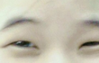 여판에 올라온 쌍수 전/후 나 이제 여자 못 믿게써....