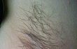 ★사진有★여자 겨드랑이 제모에 대해서 어떻게 생각함?