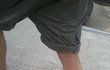 (사진有)★추가★다리에 Y자글자생겼어욬ㅋㅋㅋㅋㅋㅋㅋ