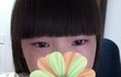 ★★★★★★★렌즈부작용의최후(사진有느님)★★★★★★★