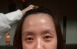 (사진有)20女 코성형+쌍수 무료이벤트당첨!!!!!!!!!!