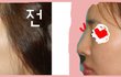 저 코좀 높아진것 같나요??!??! 꼭좀봐주세요ㅜㅜ