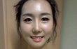 양악수술 김채연???? 대박