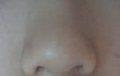 ★☆★코가 너무 못생겼어요 ㅠㅠ 사진 有★☆★