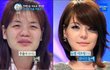 여자얼굴 성형 극과극(사진충격)