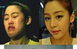 주걱턱녀 허예은 예뻐져서 좋다잉((사진有))