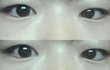 사진有+) 쌍수가 필요할까요?