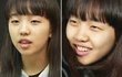 백아연 소희 닮은꼴 변신~ 몰라보게 달라진 입매 비결은?? 