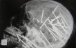 미스테리포토타임) 기괴한 X-Ray 사진