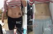 허리에 튜브를 제거한 다이어트!! (32 - > 26~7) = 예고편