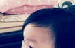 잔병치례가 많아도 너 ~무 많은 10개월 울 아들...다들 그런가요?