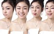 김연아...