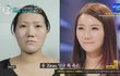 바노바기성형외과 이번엔 이승연과 100인의 여자 나온다던데?