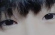 모든 실수를 제 탓으로 하는 성형외과 어떻게 해야 할까요(스압)