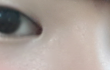 쌍수할지 말지 넘 고민이에요 ㅠㅠ 조언좀!!