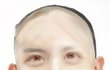 ◑◑◑ 윤초코얼짱님 성형부작용(혐) ◑◑◑