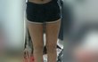 사진有) 다리좀봐주세영 ㅠㅠㅠㅠ