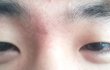 눈 성형 고민... 내눈 어때요?;;;