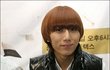 비스트 장현승 성형한거 확실함.