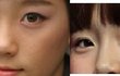 성형이 잘됫나요?