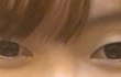 이 눈 성형하면 이쁠까요?