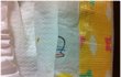 기저귀에서 살아있는 구더기가 나왔습니다