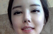 성형 잘됬盧 ?