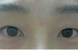 저 쌍수하면 이뻐질 수 있을까여 ㅠㅠ 제발 답좀..ㅠㅠ